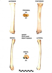 Right radius