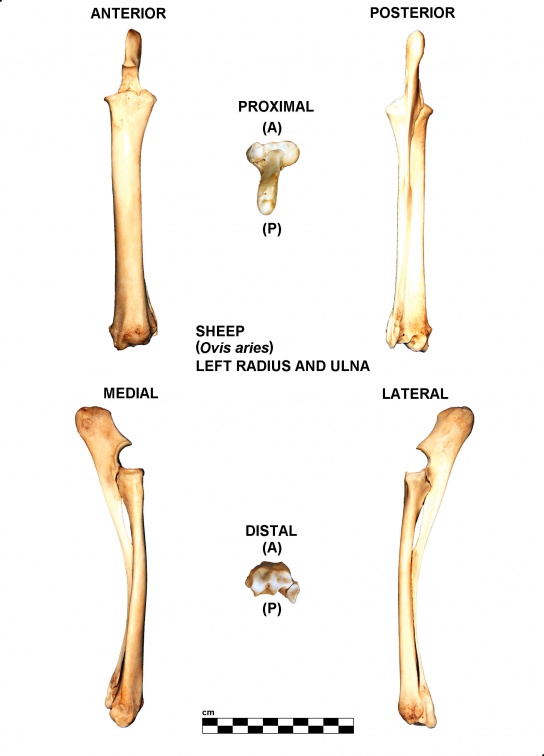 Radius et ulna gauches