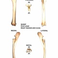 Radius et ulna droits