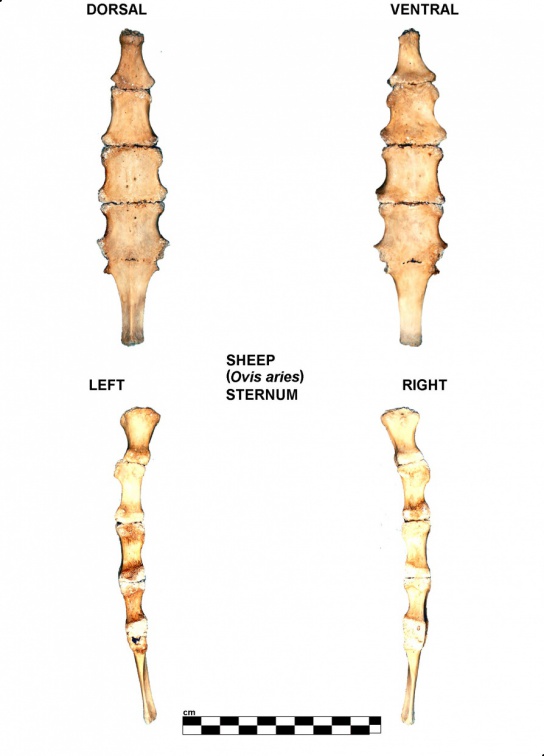 Sternum