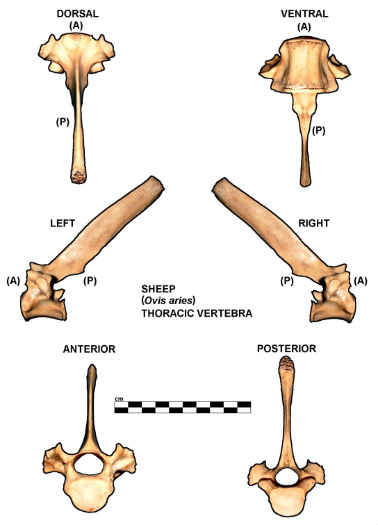 Vertèbre thoracique