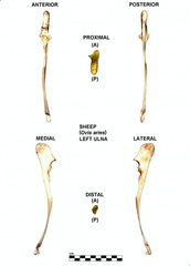 Ulna gauche