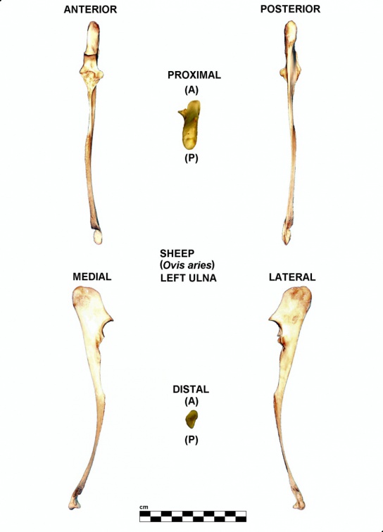 Ulna gauche