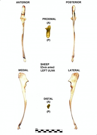 Ulna gauche
