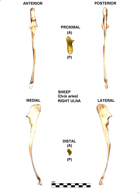 Ulna droite