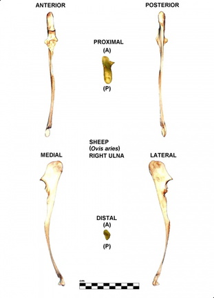 Ulna droite