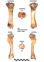 Right tibia