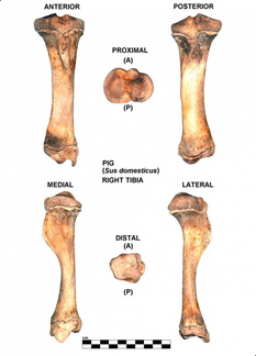 Tibia droit