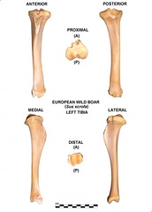 Tibia izquierdo