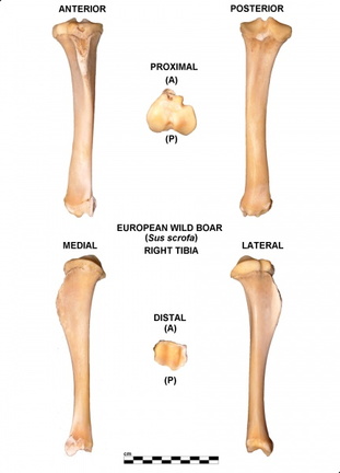 Tibia droit