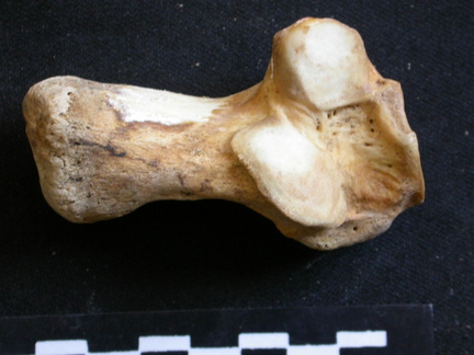 Calcaneus