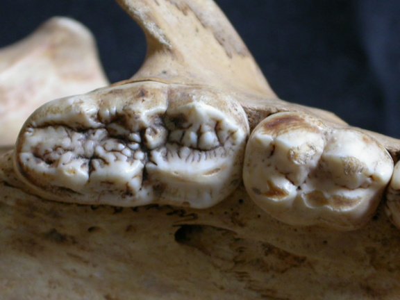 Dentition supérieure