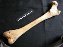 Femur