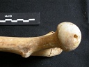 Femur: proximale part