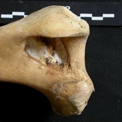 Humerus: distal part