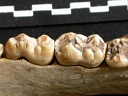 Lower teeth