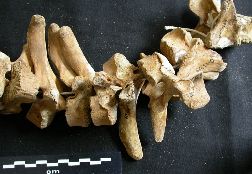 Thoracic vertebrae