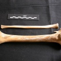 Tibia et fibula