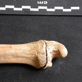 Ulna : parte distal