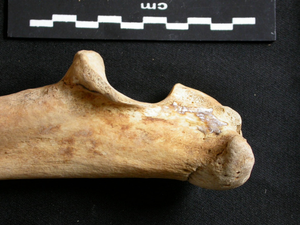 Ulna : parte proximal