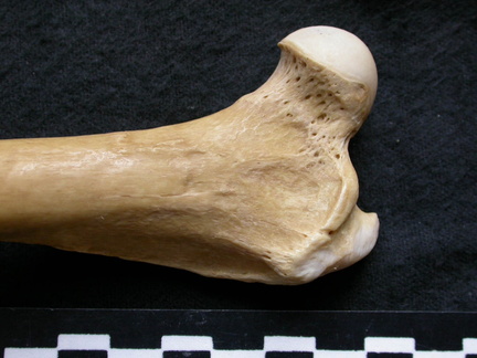 Femur: proximale part