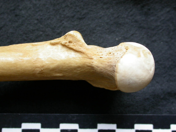 Femur: proximale part