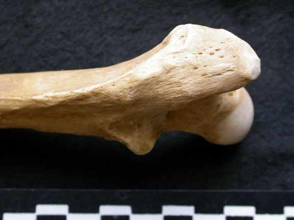 Femur: proximale part