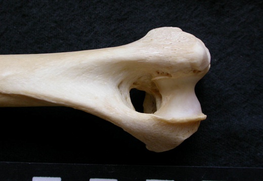 Humerus: distal part