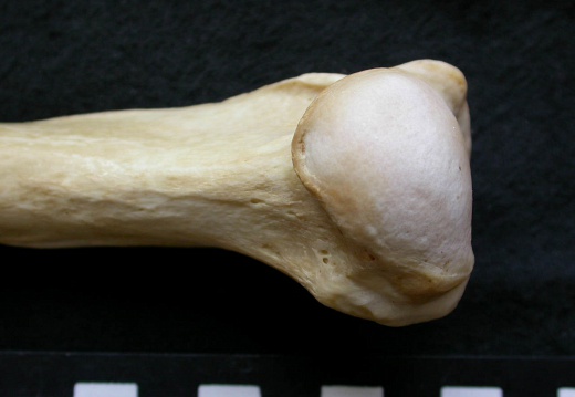 Humerus: proximale part