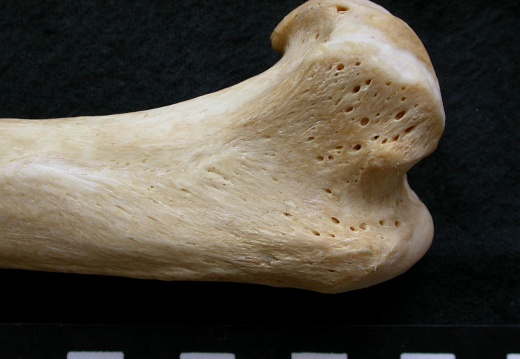 Humerus: proximale part