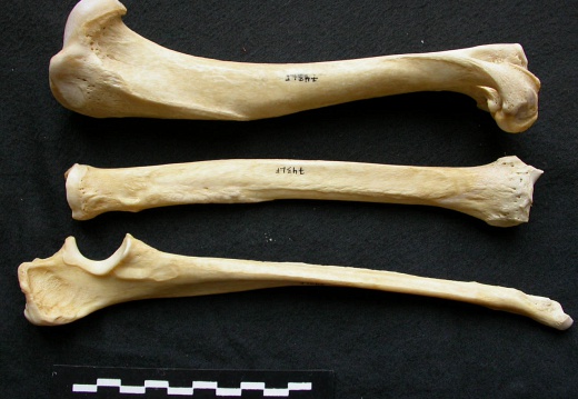 Humerus,radius and ulna