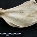 Scapula: medial view