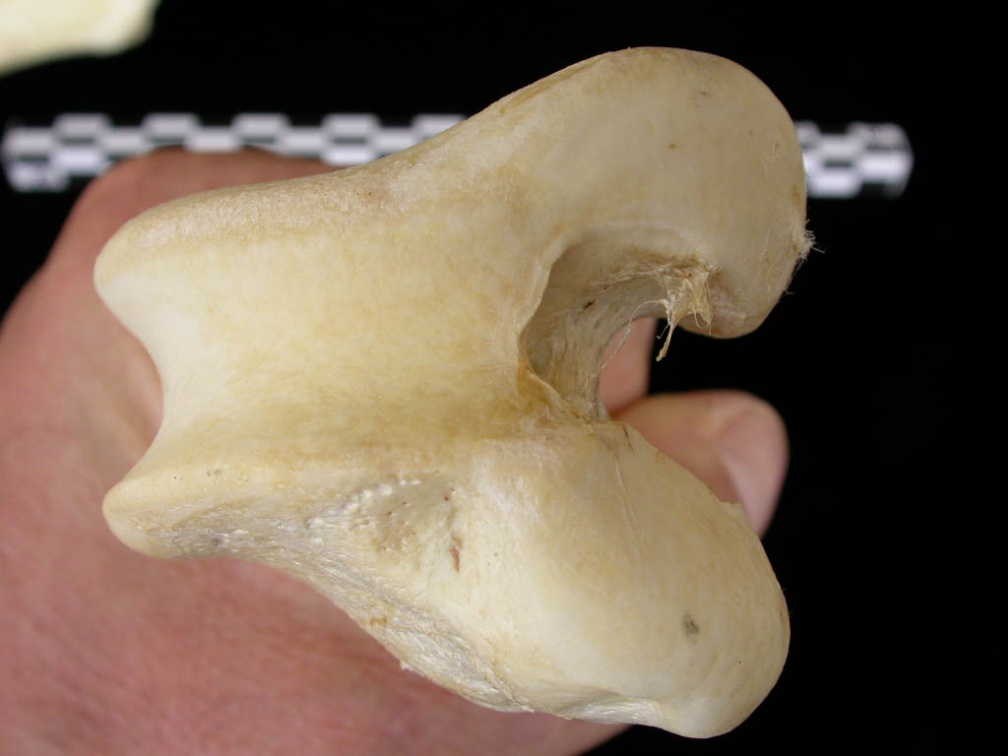 Fémur : partie distale