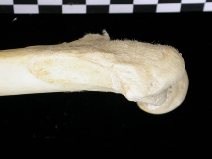 Femur: proximale part