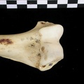 Humerus: distal part