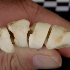 Metacarpals: proximale part