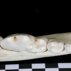 Dentition inférieure