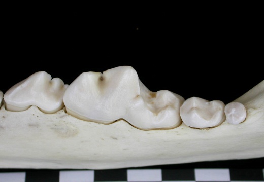 Lower teeth