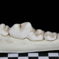 Dentition inférieure