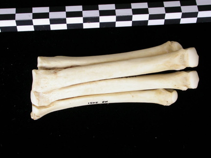 Metatarsals