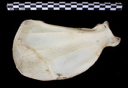 Scapula: medial view