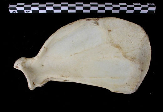 Scapula : vue médiale