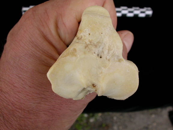 Tibia : partie proximale