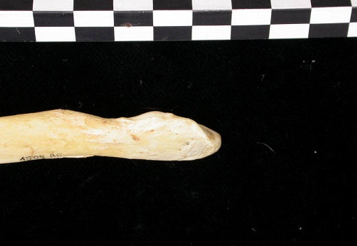  Ulna: distal part