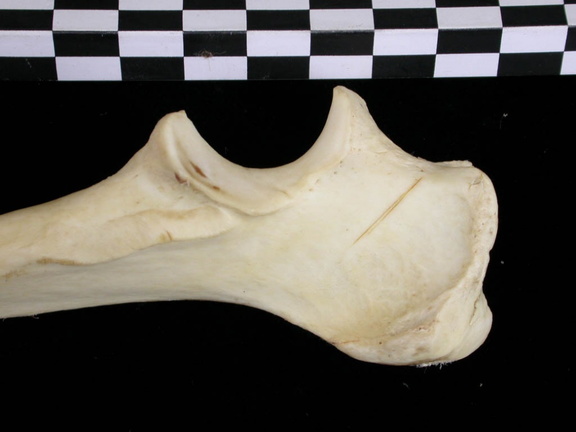 Ulna : parte proximal