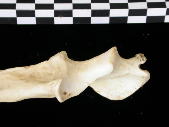 Ulna : parte proximal