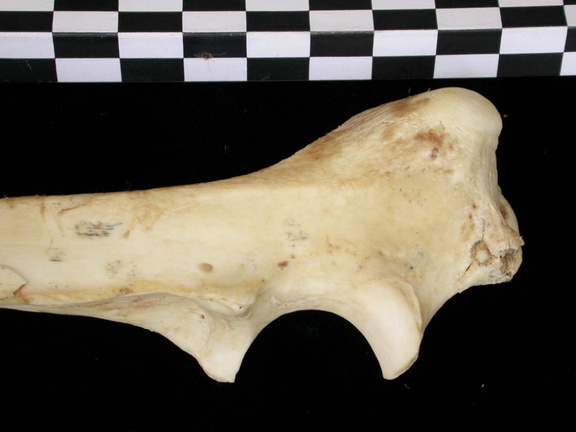 Ulna : parte proximal