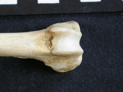 Femur: distal part