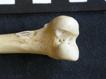 Femur: distal part