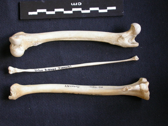  Femur, tibia and fibula
